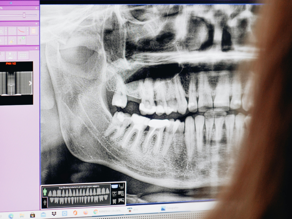 Paciente en clínica dental en Lanzarote aprendiendo la relación entre salud bucal y salud general